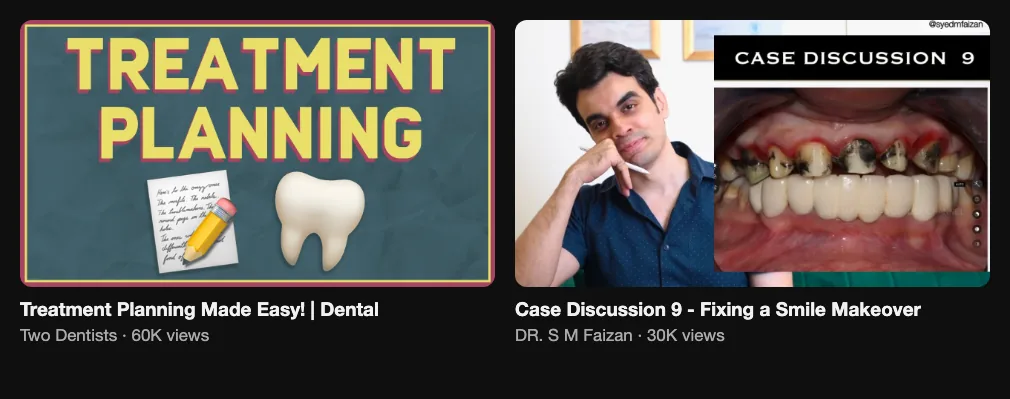 References for a video for dentists: Two Dentists, Treatment Planning Made Easy, 60K views; Dr. S M Faizan, Case Discussion 9 - Fixing a Smile Makeover, 30K views