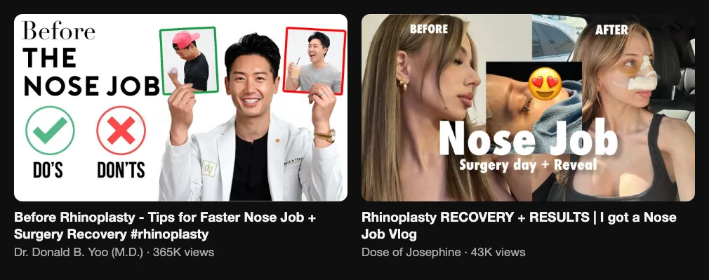 References for a rhinoplasty recovery video: Dr. Donald B. Yoo, Before Rhinoplasty tips, 365K views; Dose of Josephine, Rhinoplasty recovery and results, 43K views
