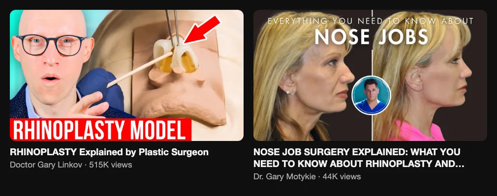 References for a revision rhinoplasty video: Doctor Gary Linkov, RHINOPLASTY Explained by Plastic Surgeon, 515K views; Dr. Gary Motykie, Nose job surgery explained, 44K views
